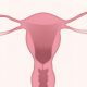 ce este cancerul de col uterin, boli ginecologice