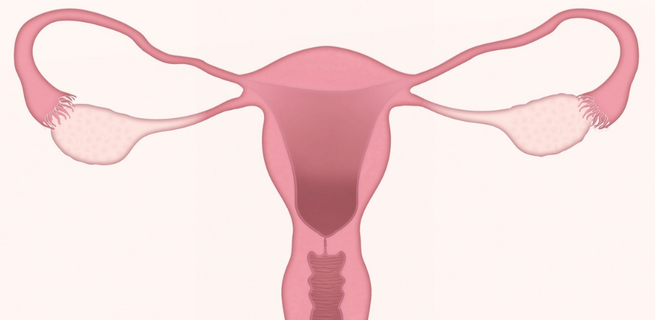 ce este cancerul de col uterin, boli ginecologice