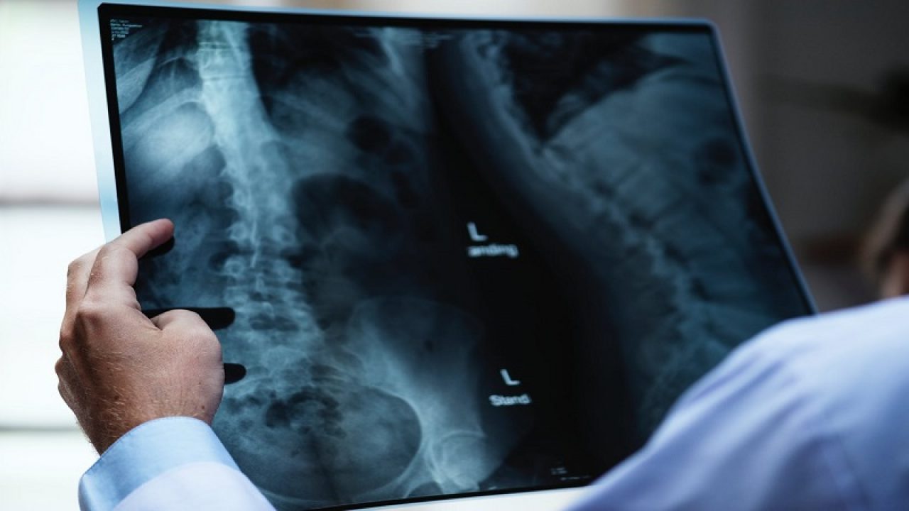 artroza articulației fațete a coloanei vertebrale toracice