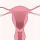 cancer ovarian, boli ginecologice
