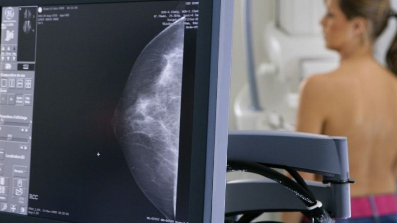 pierderea în greutate și mamografia anormală