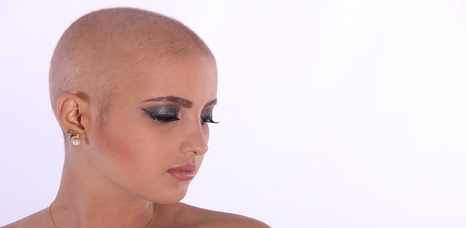 Tipuri de alopecie