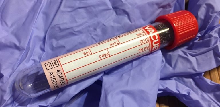 Sideremia indicatii si interpretare rezultate Sfaturimedicale.ro