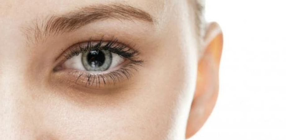 cearcane negre sub ochi cauze cremă anti-îmbătrânire pentru piele