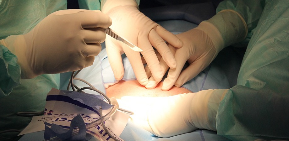 erecție  durata sa în actul sexual rezultate după intervenția chirurgicală de mărire a penisului