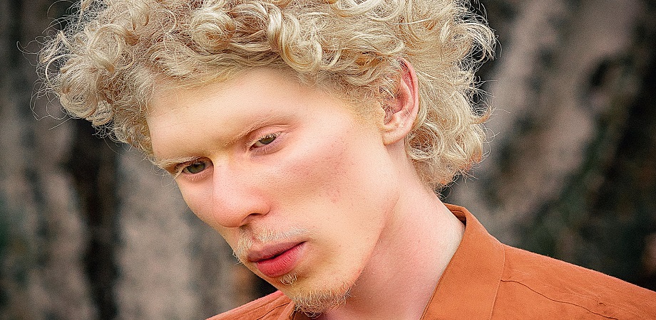 Albinismul