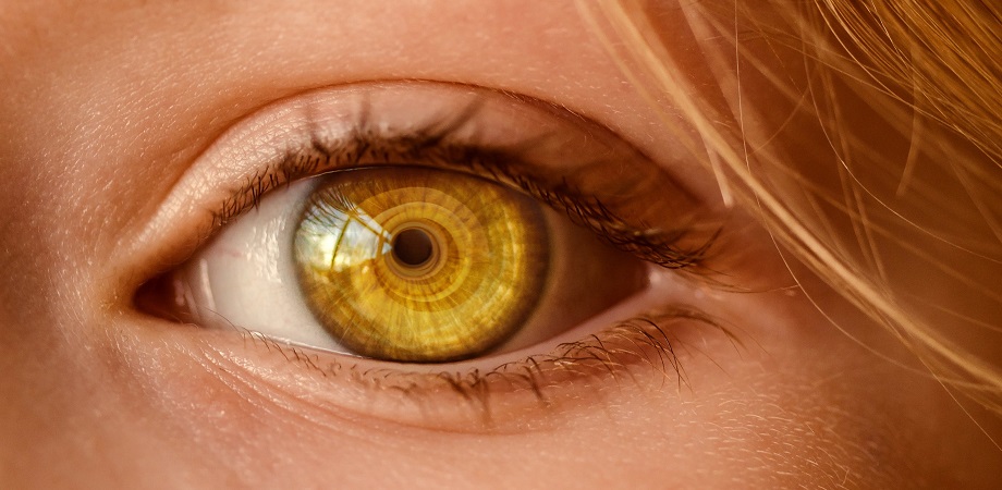 istoric de caz în keratocon oftalmologie
