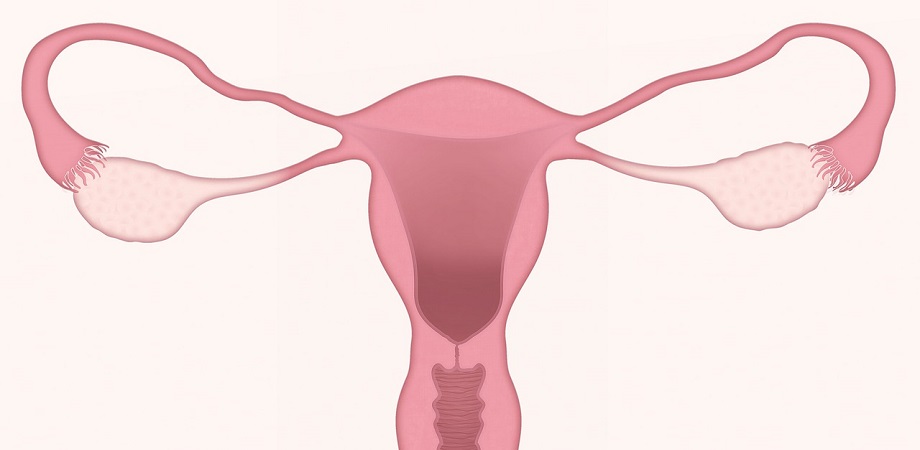 cancer-endometrial
