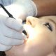 granulomul dentar