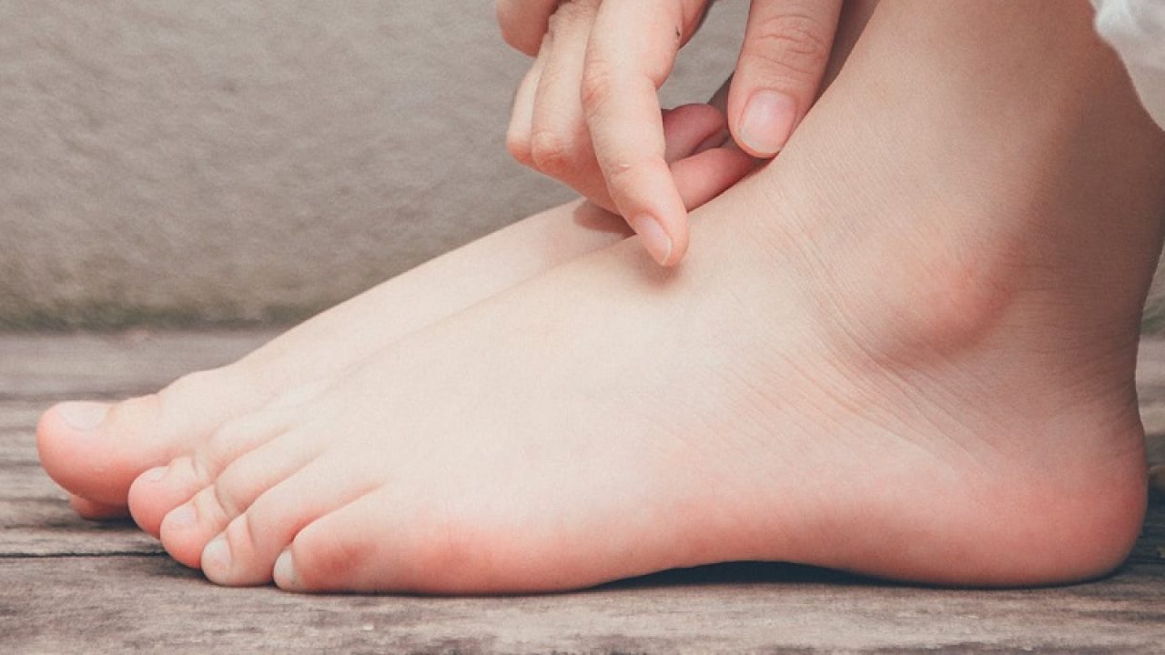 Picioare plate și dureri de gleznă - SFATUL SPECIALISTULUI