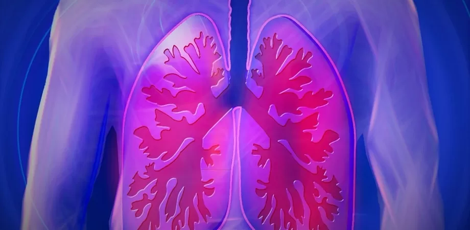 ce este pneumonia