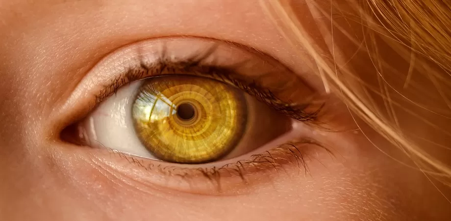 Ce reprezinta heterocromia?
