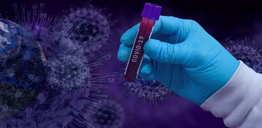 test elisa covid 19